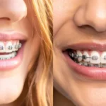 Best Orthodontist in London