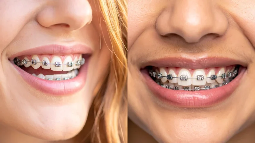 Best Orthodontist in London