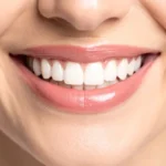 Best Orthodontist in Massachusetts 3