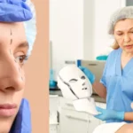 Best Plastic Surgeon in Washington Dc