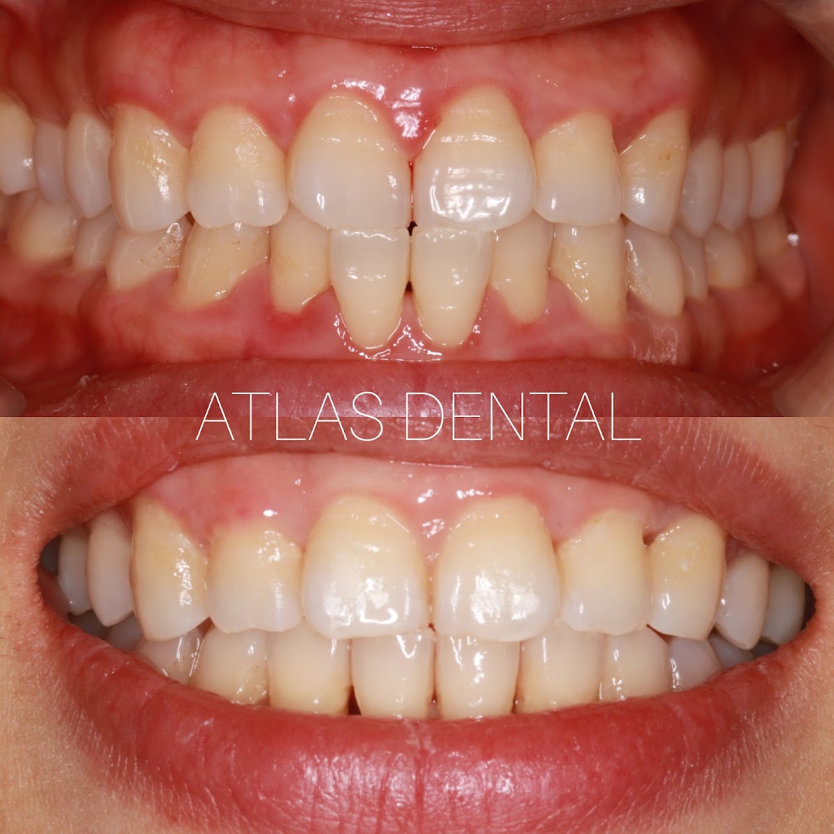 Dentist in Toronto -- Atlas Dental (2)