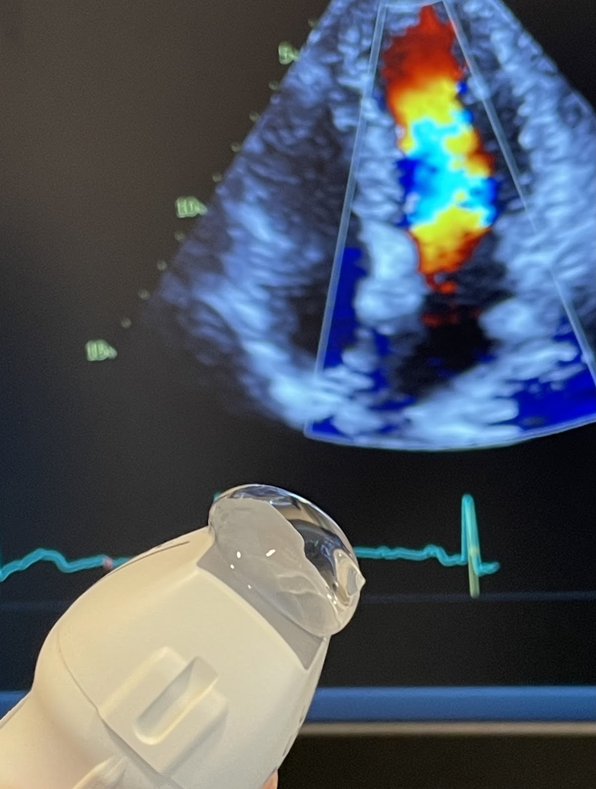 Cardiologist in Singapore -- Heart Specialist International (Mount Elizabeth Novena Specialist Centre)